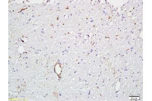 Formalin-fixed and paraffin embedded rat brain tissue  at 1:300 followed by conjugation to the secondary antibody and DAB staining. (VWF anticorps  (AA 701-800))