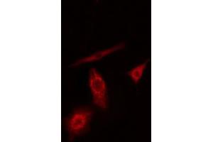 ABIN6274186 staining A549 cells by IF/ICC. (PFKL anticorps  (C-Term))