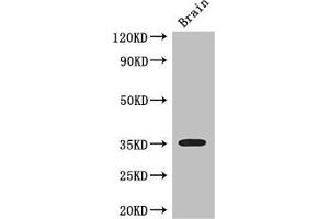 Western Blot Positive WB detected in: Mouse brain tissue All lanes: SFRP1 antibody at 3 μg/mL Secondary Goat polyclonal to rabbit IgG at 1/50000 dilution Predicted band size: 36 kDa Observed band size: 36 kDa (SFRP1 anticorps  (AA 170-240))