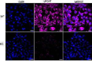 Immunocytochemical staining of HeLa cells using LPCAT1 antibody (ABIN7799305), 1:1,000), Top panel: wild-type (WT), Bottom panal: LPCAT1 shRNA knockdown (KD).
