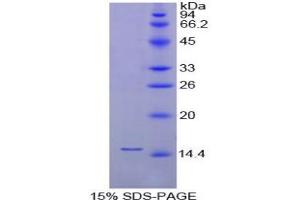 SDS-PAGE analysis of Chicken FABP1 Protein. (FABP1 Protéine)