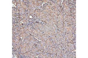 IHC analysis of MVP using anti-MVP antibody (ABIN7600481).