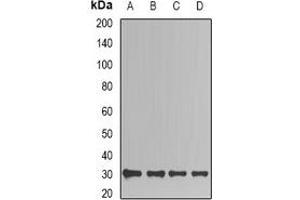 Western blot analysis of TIM expression in Jurkat (A), HepG2 (B), mouse kidney (C), mouse brain (D) whole cell lysates. (TPI1 anticorps)