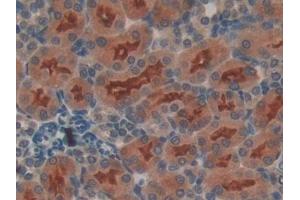 Detection of FGFRL1 in Rat Kidney Tissue using Polyclonal Antibody to Fibroblast Growth Factor Receptor Like Protein 1 (FGFRL1)