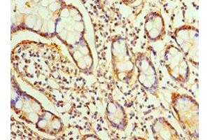 Immunohistochemistry of paraffin-embedded human small intestine tissue using ABIN7170334 at dilution of 1:100 (SRI anticorps  (AA 1-198))