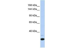 WB Suggested Anti-ZNF197 Antibody Titration:  0. (ZNF197 anticorps  (N-Term))
