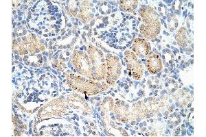 FZD7 antibody was used for immunohistochemistry at a concentration of 4-8 ug/ml to stain Epithelial cells of renal tubule (arrows) in Human Kidney. (FZD7 anticorps)