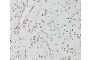 Immunohistochemistry of paraffin-embedded Human leiomyoma of uterus using RUVBL1 Polyclonal Antibody at dilution of 1:100 (40x lens). (RUVBL1 anticorps)