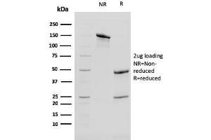 anti-Keratin 13 (KRT13) antibody