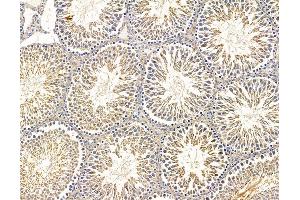 ABIN7095844 and ABIN7099906 at 1/100 staining rat testis tissue by IHC-P. (B4GALNT3 anticorps)