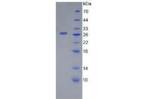 SDS-PAGE analysis of Human Galectin 12 Protein. (LGALS12 Protéine)