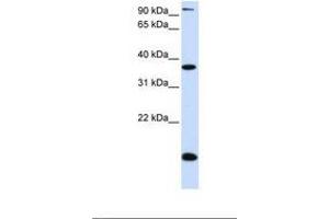 Image no. 1 for anti-Kruppel-Like Factor 8 (KLF8) (AA 74-123) antibody (ABIN6739064) (KLF8 anticorps  (AA 74-123))