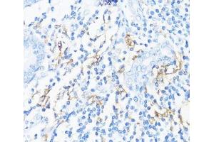 Immunohistochemistry of paraffin-embedded Human appendix using HLA-DRB3 Polyclonal Antibody at dilution of 1:100 (40x lens). (HLA-DRB3 anticorps)