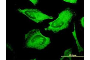 anti-Protein C Receptor, Endothelial (PROCR) (AA 1-239) antibody