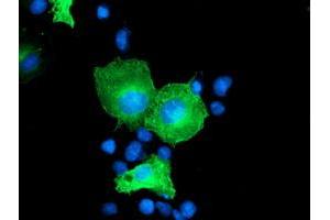 Anti-CCM2 mouse monoclonal antibody (ABIN2454949) immunofluorescent staining of COS7 cells transiently transfected by pCMV6-ENTRY CCM2 (RC201418). (CCM2 anticorps)