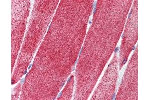 IHC Information: Paraffin embedded skeletal muscle tissue, tested with an antibody dilution of 5 ug/ml.