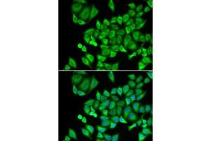 Immunofluorescence analysis of U2OS cells using DHRS9 antibody (ABIN6130324, ABIN6139603, ABIN6139604 and ABIN6221932). (DHRS9 anticorps  (AA 18-319))