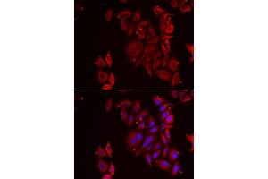 Immunofluorescence analysis of U2OS cells using PAICS antibody. (PAICS anticorps  (AA 176-425))