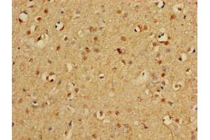 Immunohistochemistry of paraffin-embedded human brain tissue using ABIN7164952 at dilution of 1:100