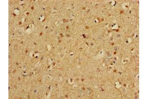 Immunohistochemistry of paraffin-embedded human brain tissue using ABIN7164952 at dilution of 1:100 (PSMA3 anticorps  (AA 218-248))