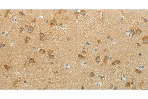 Immunohistochemistry of paraffin-embedded Human brain using NDRG3 Polyclonal Antibody at dilution of 1:70