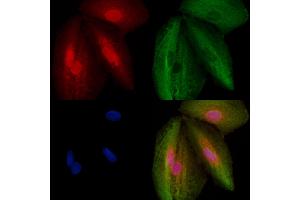 ABIN6259117 and ABIN6273494 staining  cells by IF/ICC. (MORG1 anticorps  (Internal Region))