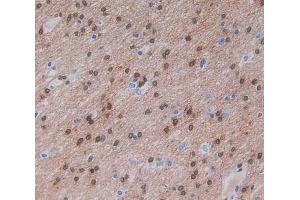 Used in DAB staining on fromalin fixed paraffin- embedded brain tissue (Nischarin anticorps  (AA 1246-1346))