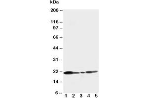 Western blot testing of Caveolin-1 antibody and Lane 1:  U87;  2: HeLa;  3: MCF-7;  4: A549;  5: HT1080 cell lysate (Caveolin-1 anticorps  (C-Term))