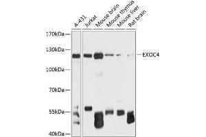 Western blot analysis of extracts of various cell lines, using EXOC4 antibody (ABIN6127883, ABIN6140366, ABIN6140367 and ABIN6215986) at 1:3000 dilution.