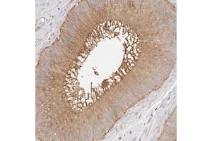 Immunohistochemical staining of human epididymis with TTLL4 polyclonal antibody  shows moderate cytoplasmic and membranous positivity in glandular cells. (TTLL4 anticorps)