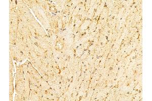 ABIN6265995 and ABIN6273344 at 1/100 staining Mouse heart tissue by IHC-P. (VPS11 anticorps  (Internal Region))