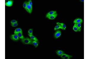 Immunofluorescence staining of HepG2 cells with ABIN7163983 at 1:66, counter-stained with DAPI. (Kcne3 anticorps  (AA 1-57))
