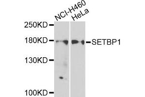 Western blot analysis of extracts of NCI-H460 and HeLa cells, using SETBP1 antibody. (SETBP1 anticorps)