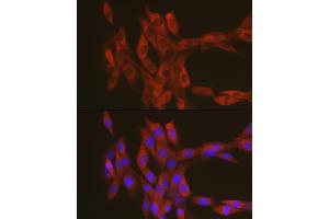Immunofluorescence analysis of NIH-3T3 cells using RhoA Rabbit pAb (ABIN3020848, ABIN3020849, ABIN3020850 and ABIN6213755) at dilution of 1:100 (40x lens).