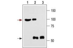 Immunoprecipitation of rat brain lysate: - 1.
