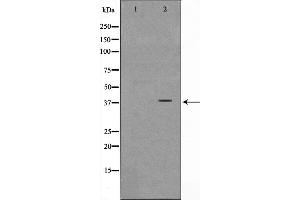 Western blot analysis on Jurkat cell lysate using NT5C3 Antibody,The lane on the left is treated with the antigen-specific peptide. (NT5C3 anticorps  (N-Term))