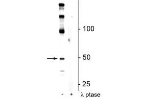 Western blot of mouse hippocampal lysate showing specific immunolabeling of the ~50 kDa eEF1A2 protein phosphorylated at Ser358 in the first lane (-).