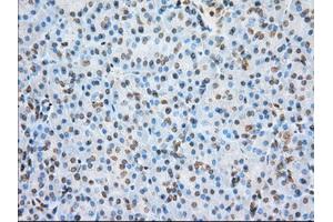 Immunohistochemical staining of paraffin-embedded colon tissue using anti-ERCC1 mouse monoclonal antibody. (ERCC1 anticorps)