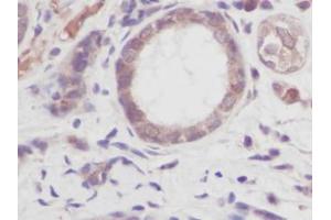 Image no. 1 for anti-Tumor Necrosis Factor alpha (TNF alpha) antibody (ABIN465030) (TNF alpha anticorps)