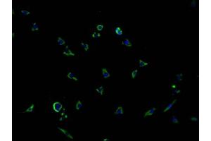 Immunofluorescence staining of SH-SY5Y cells with ABIN7166541 at 1:100, counter-stained with DAPI.