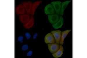 ABIN6259200 and ABIN6275528 staining Hela cells(45 min of heat-shock) by IF/ICC.