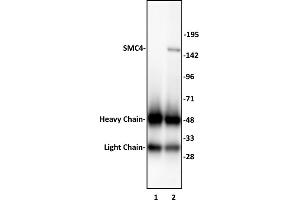 SMC4 antibody (pAb) tested by Immunoprecipitation.