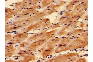 Immunocytochemistry analysis of human heart tissue using ABIN7171476 at dilution of 1:100