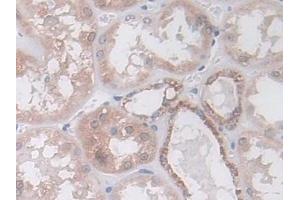 Detection of IDH2 in Human Kidney Tissue using Polyclonal Antibody to Isocitrate Dehydrogenase 2, mitochondrial (IDH2)