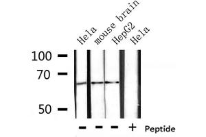 Western blot analysis of extracts from Hela, mouse brain, HepG2, using CTPS Antibody. (CTP Synthase anticorps  (C-Term))