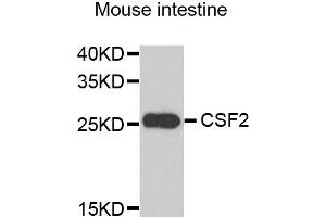 Western blot analysis of extracts of mouse intestine, using CSF2 antibody. (GM-CSF anticorps)