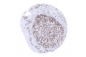 tonsil surface epithelium (Ki-67 anticorps  (AA 2293-2478))