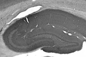Adult rat hippocampus immunohistochemistry. (CNTNAP2 anticorps  (Extracellular))