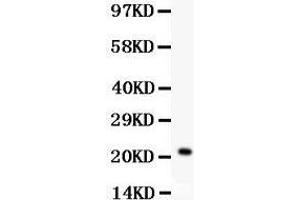Anti- IL18 Picoband antibody, Western blotting All lanes: Anti IL18  at 0. (IL-18 anticorps  (AA 36-192))