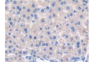 DAB staining on IHC-P; Samples: Mouse Liver Tissue